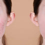Calcaire et peau sĂšche : comment lâeau filtrĂ©e peut protĂ©ger votre visage ?